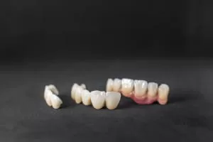 Dental Crowns